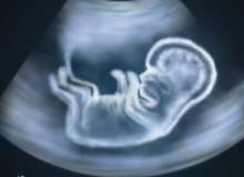 Hamileliğin 31. haftasında bebeğin hareketleri bilinçli midir?