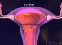 Spiral Taktıran Kadınlar Rahim Ağzı Kanserine Daha Az Yakalanıyor Spiral Taktıran Kadınlar Rahim Ağzı Kanserine Daha Az Yakalanıyor