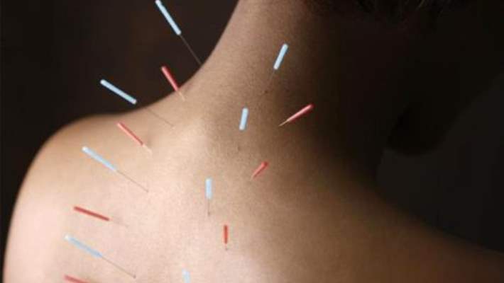 Yalnızca Akupunktur Tedavisiyle Kilo Verilebilir Mi?