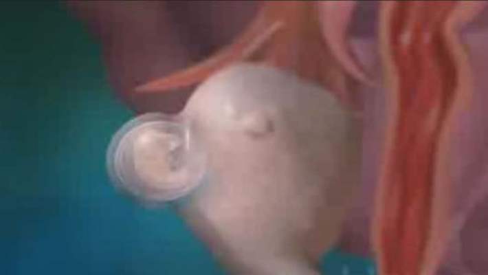 Yalancı Gebeliğin Nedenleri Nelerdir?