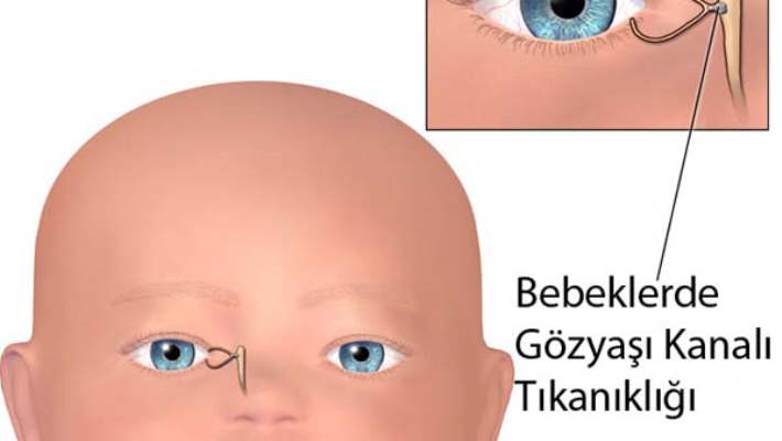 Bebeklerde Sulanma Ve Çapaklanma