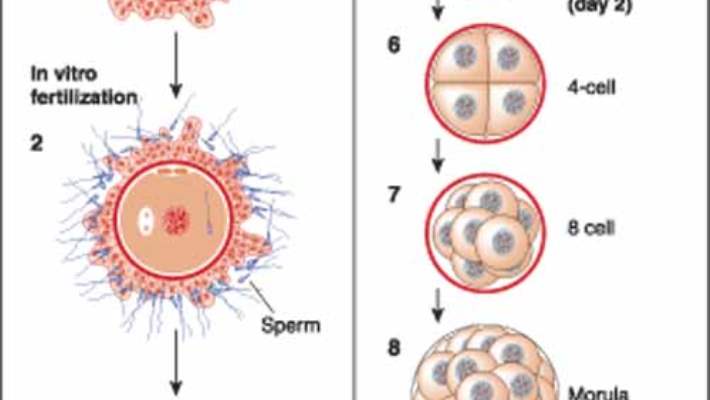 Kadınlarda Yumurtlamayı Engelleyen Faktörler Nelerdir Hangi?