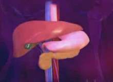 Malabsorpsiyon Sendromu Malabsorpsiyon Sendromu