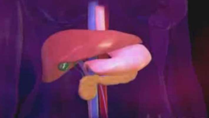 Malabsorpsiyon Sendromu