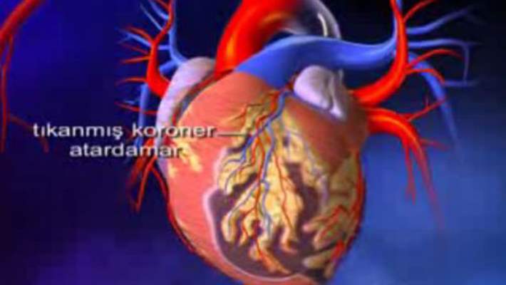 Kimyasal Maddeler Damar Sertliğine Yol Açabilir