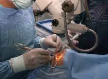 Radyal Keratotomi Radyal Keratotomi