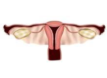 Vajina estetiği orgazmı nasıl kolaylaştırır? Vajina estetiği orgazmı nasıl kolaylaştırır?