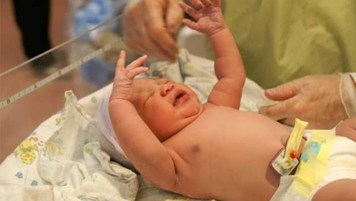 İkizlerin Kordon Kanı Nasıl Alınır?