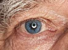 Gerontofili Gerontofili