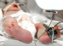 Her Yıl 13 Milyon Bebek Prematüre Olarak Doğuyor