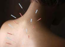 Tüp bebek tedavisinde akupunktur ve nöral terapi, gebelik şansını arttırır mı?