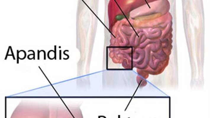 Çocuklarda Apandisit Daha Çabuk Patlıyor