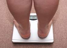 Robotik Cerrahiyle Göbek Deliğinden Obezite Ameliyatı Robotik Cerrahiyle Göbek Deliğinden Obezite Ameliyatı