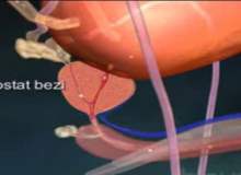 Benign Prostat Hiperplazisi (Prostatta İyi Huylu Büyüme) Benign Prostat Hiperplazisi (Prostatta İyi Huylu Büyüme)