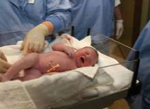 Sezaryenle Doğumda Komplikasyon Riski 3 Kat Artırıyor Sezaryenle Doğumda Komplikasyon Riski 3 Kat Artırıyor