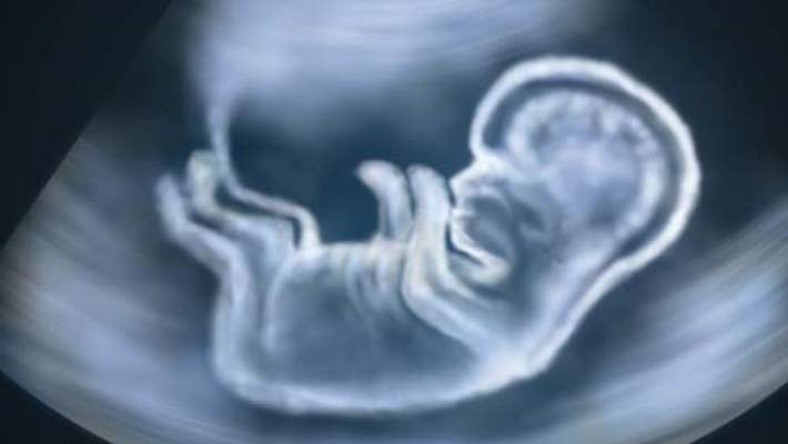 Doğmamış Bebekte Kalp Deliği Olduğu Anlaşılabilir Mi?