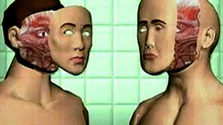 Dünya, Türkiye''nin İlk ''''Yüz Nakli'''' Ameliyatını Konuşuyor