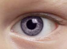 Kök Hücreyle Göz Tedavisinde İlk Aşama Geçildi Kök Hücreyle Göz Tedavisinde İlk Aşama Geçildi