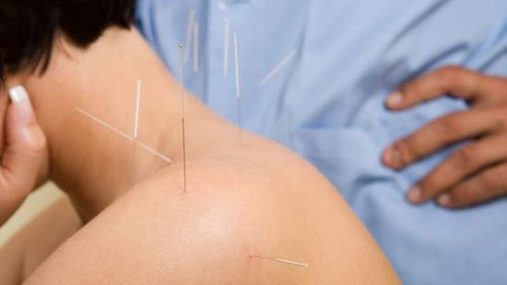Kilo Vermek İçin Kullanılan Akupunktur Yöntemleri Nelerdir?