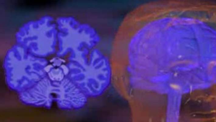 Parkinson Hastalığında Gelişme