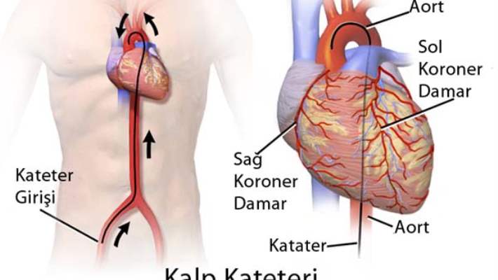 Kalbiniz Hayatınızın Ritmini Bozmasın!