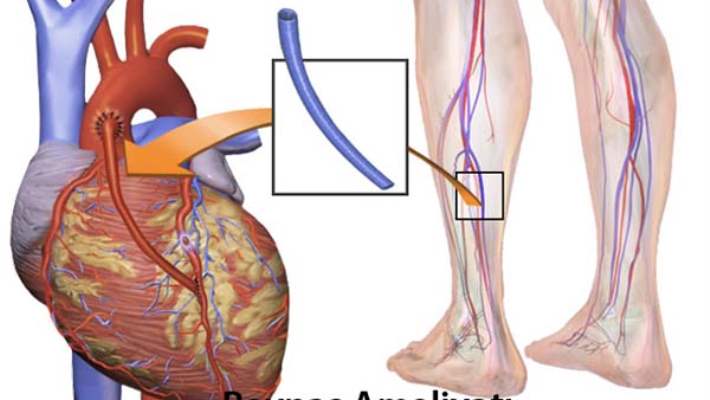 Koroner Arterde Ürkütücü Sıralama