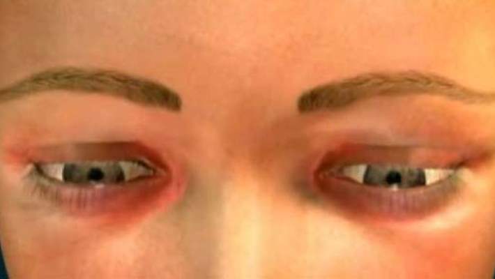 Gözyaşlarını Tükürük Bezleri Akıtacak