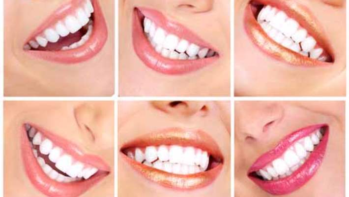 Karbonat Dişleri Beyazlatır Mı?