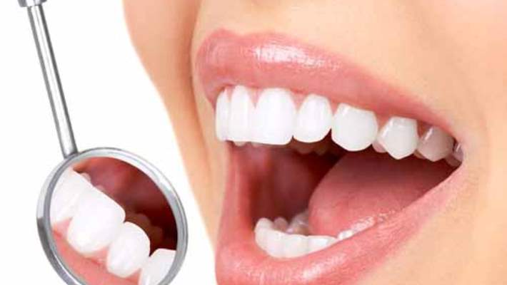 Diş Hekimlerinin Kullandığı Diş Beyazlatma Yöntemleri Nelerdir?