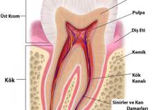 Çekilen dişin boşluğu nasıl tedavi edilir?