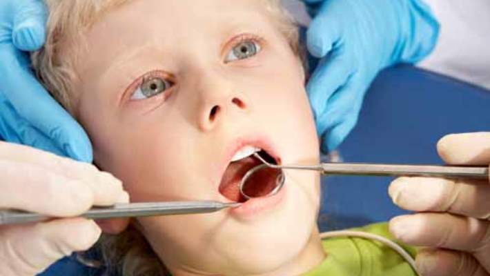 Çocuklarda Kullanılan Diş Telleri Nasıl Olur?