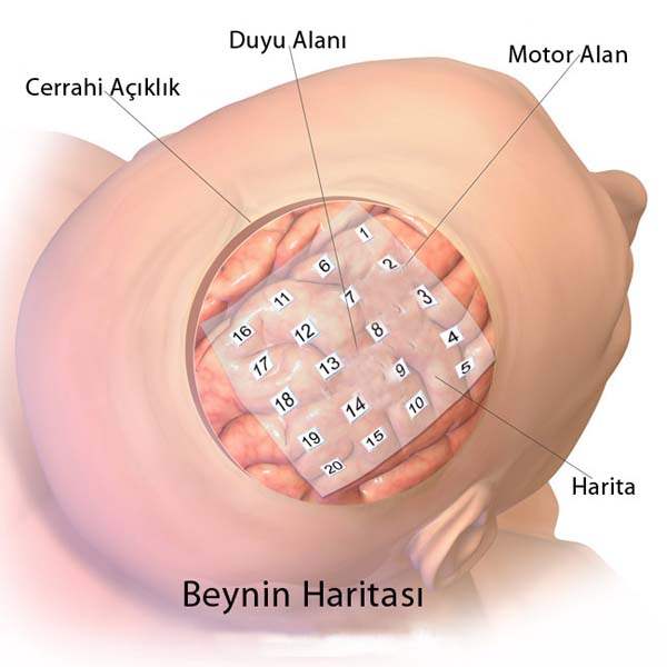Hipotalamus nasıl bir organdır?