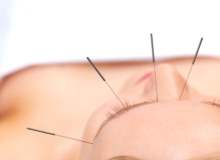 Baş ağrısı tedavisinde akupunktur yöntemi