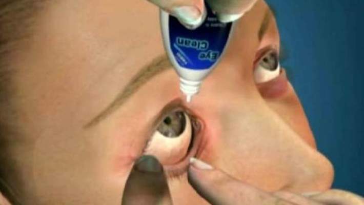 Kirpik Dibi İltihabı