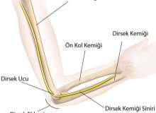 Zengin Plazma (TZP) Tenisçi Dirseğine Yardım eder Zengin Plazma (TZP) Tenisçi Dirseğine Yardım eder