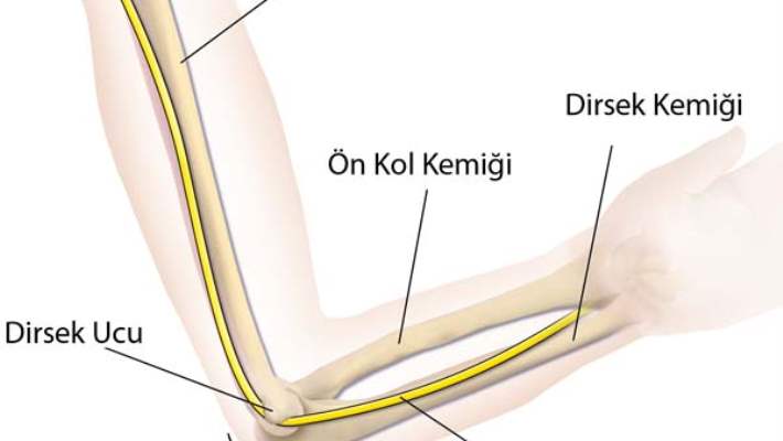 Zengin Plazma (Tzp) Tenisçi Dirseğine Yardım Eder