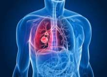 Akciğer amfizemi hastalarının yapması gereken egzersizler neledir?