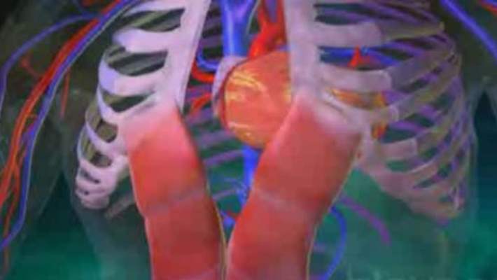 Her Ağrı Kriz Belirtisi Değil