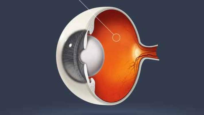 İleri Yaşlarda Görülen Retina Hastalıkları