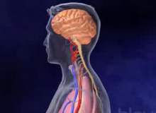 Beyin Kanaması Riski Altında Olanlar Beyin Kanaması Riski Altında Olanlar