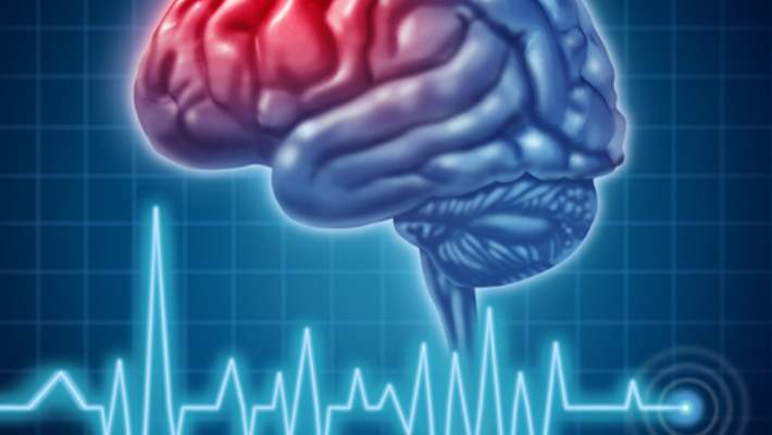 Beyin Kanaması Geçirenlere Öneriler