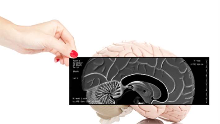 Beyin Kanaması Riskini Azaltmanın Yolları