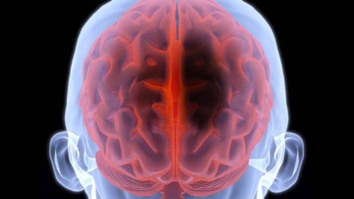 Beyin Kanaması Riskini Arttıran Hastalıklar
