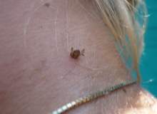 Böcek Isırmasının Yol Açtığı Alerjik Reaksiyonlar Böcek Isırmasının Yol Açtığı Alerjik Reaksiyonlar