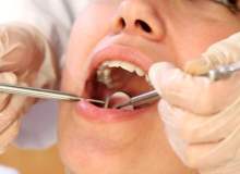 Çenede ağrıya neden olan diş sorunları nelerdir?
