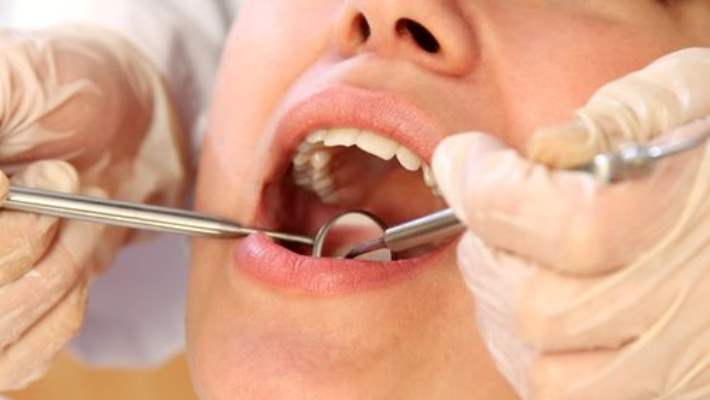 Çenede Ağrıya Neden Olan Diş Sorunları Nelerdir?