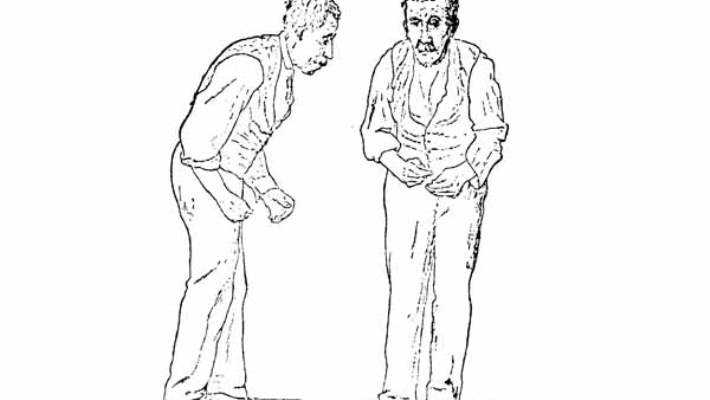 Parkinson Ameliyatı