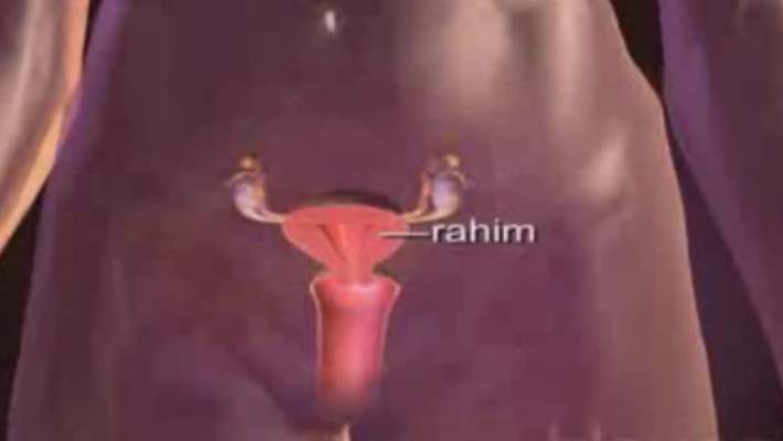 Rahim Ağzı Kanserinin Oluşum Aşamaları