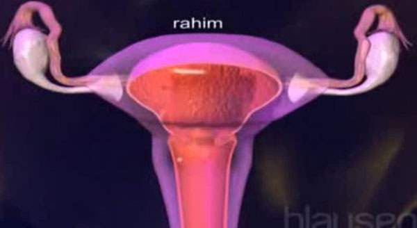 Rahim kanserinde erken teşhis yöntemleri