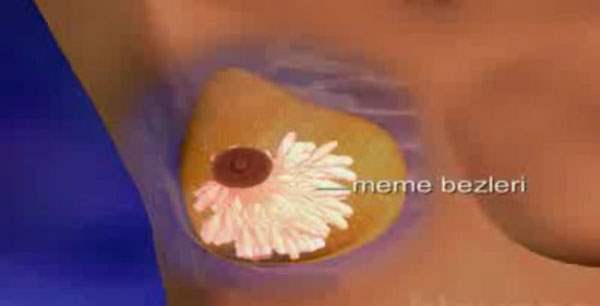 Meme Kanseri Tedavisinde Yeni Teknikler